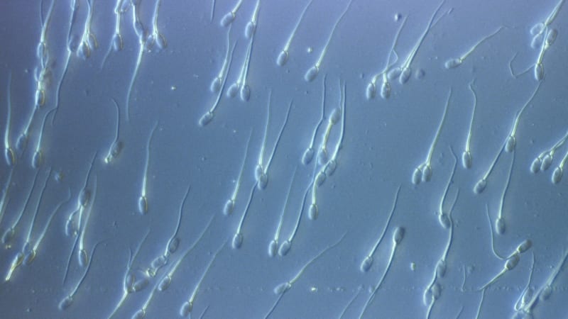 Skandál s darovaným spermatem otřásá Evropou: Zemřelo několik dětí, rodiny se bojí rakoviny