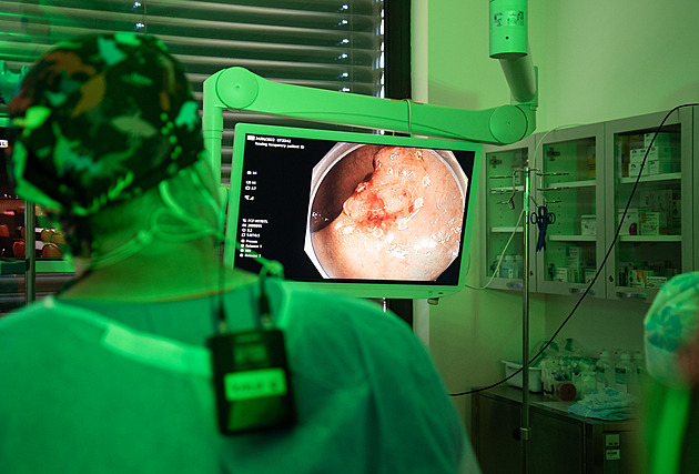 Chytré kolonoskopy s AI vidí i malé polypy, v Olomouci díky nim vyšetří více pacientů